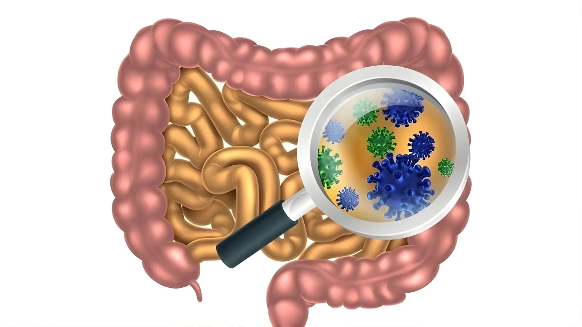 Cryptosporidium trong nước gây nên triệu chứng phổ biến