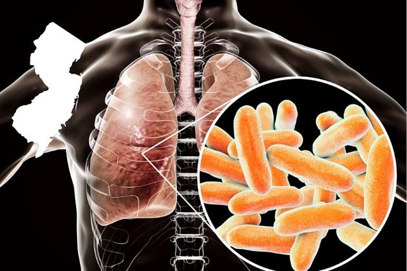 Legionella trong nước - Nguy cơ tiềm ẩn và giải pháp cho nguồn nước tại việt nam Nhiễm trùng Legionella và viêm phổi do Legionella